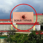 Scrub typhus