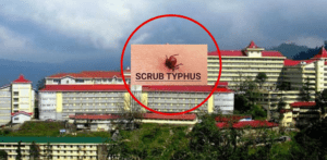 Scrub typhus